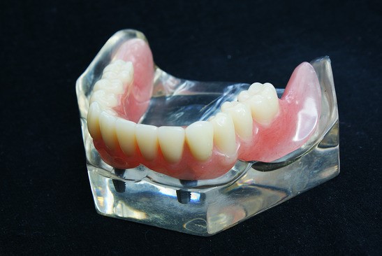 Dentures Problems Erwin TN 37650